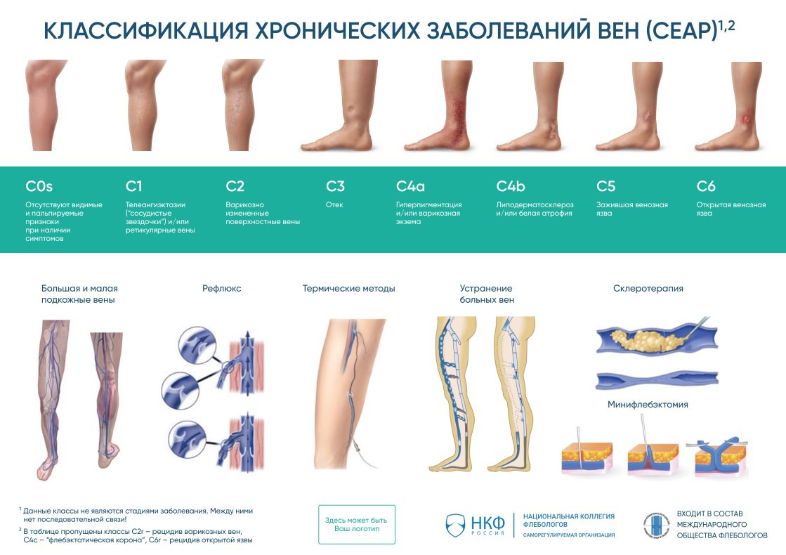 Национальная коллегия флебологов